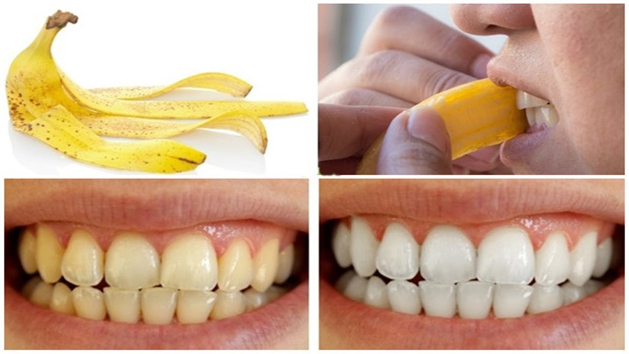 Бананы для отбеливания зубов про зубные щетки oral b
